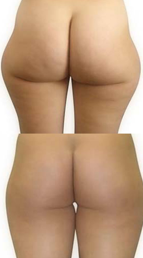 Risultato 3