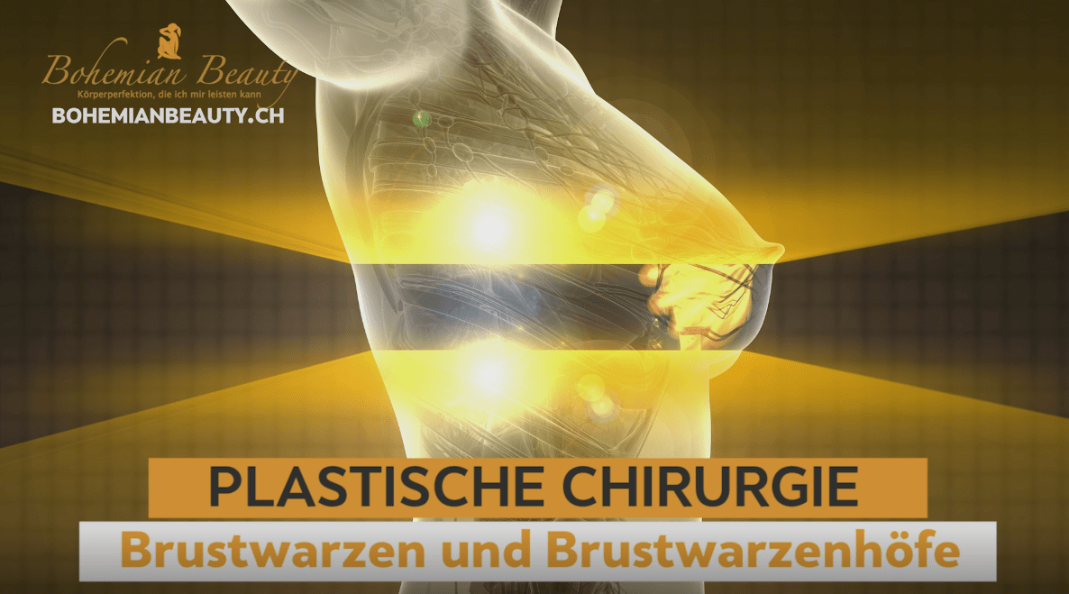 Plastische Chirurgie für Brustwarzen und Brustwarzenhöfe